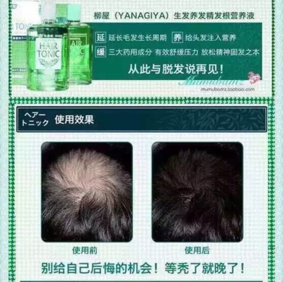 产后脱发怎么办？这些方法帮你减少掉发，拒绝秃顶危机