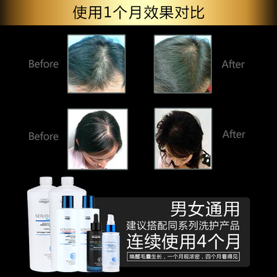 科技赋能防脱，欧莱雅芯基源洗护套装 深入发芯，重塑强韧发丝