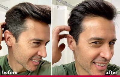 年纪轻轻就长白头发？从沐浴用品到生活方式的全方位应对指南